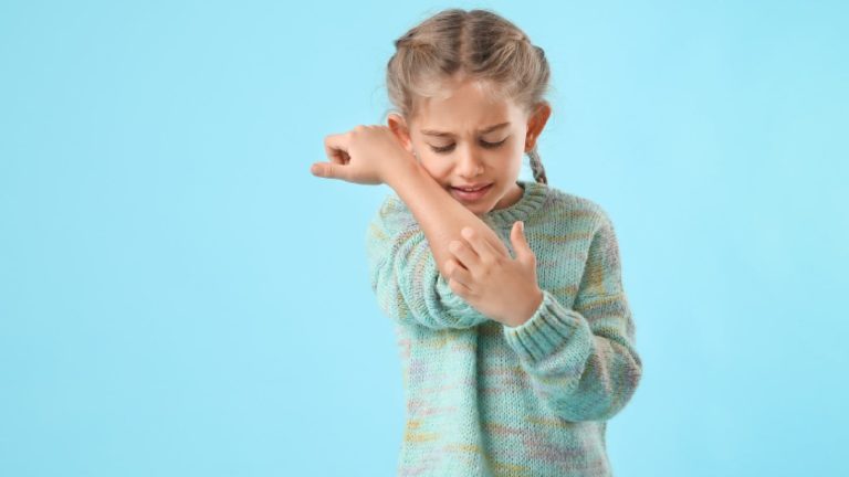 Know the causes of skin allergies in children