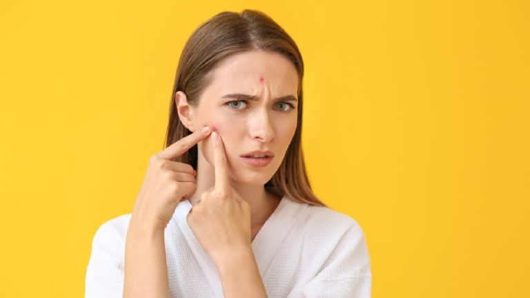 8 harmful cosmetic ingredients that can cause acne