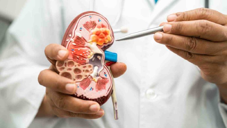 Get these 5 tests to identify kidney diseases