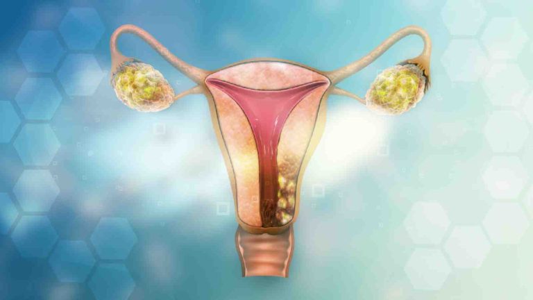 World Thyroid Day: Can thyroid impact fertility in women?