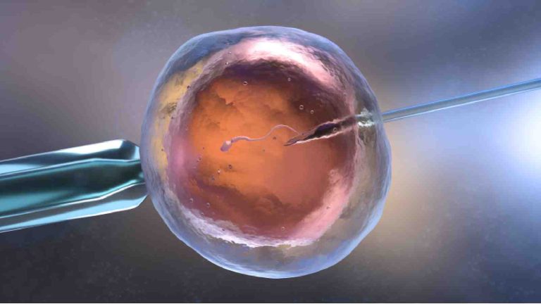 IVF after miscarriage: Here’s what you should know about it