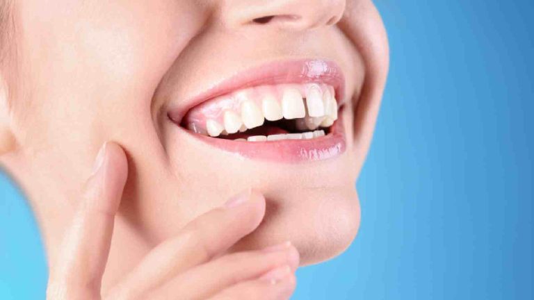 Sudden gap between teeth: Why it happens and how to prevent it