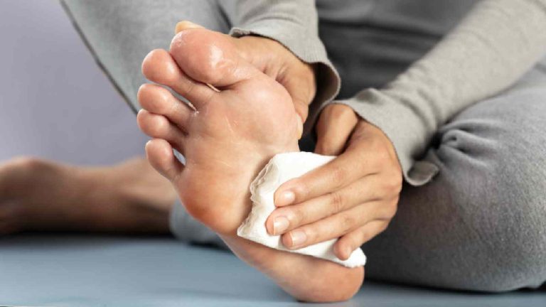 Sweaty hands and feet: Causes, treatment, and prevention