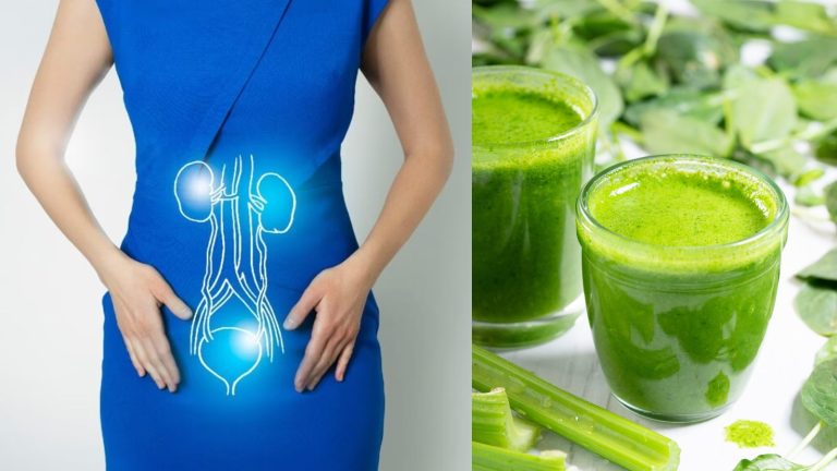 Side effects of spinach: Can spinach juice cause kidney stones?