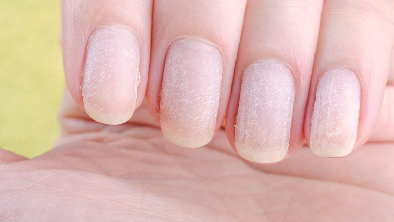 Vitamin B12 for nails: Is this nutrient good for nail growth?