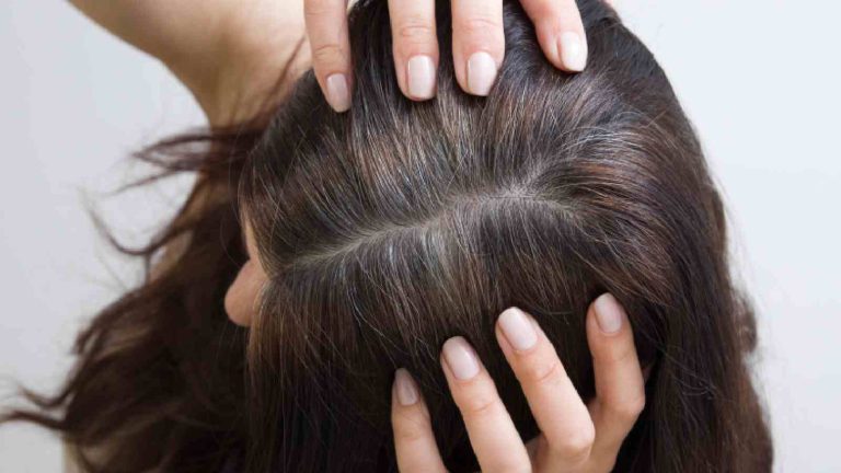 5 anti grey hair products to avoid premature greying of hair