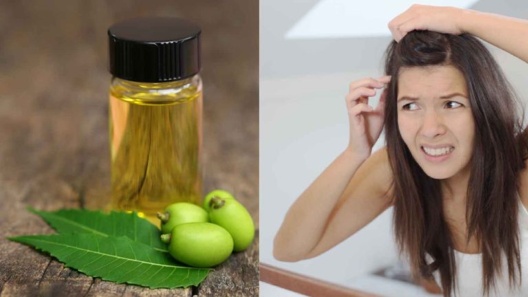 Neem oil for lice: How to get rid of hair lice naturally