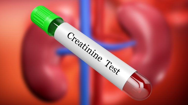 Diet tips to maintain healthy creatinine levels