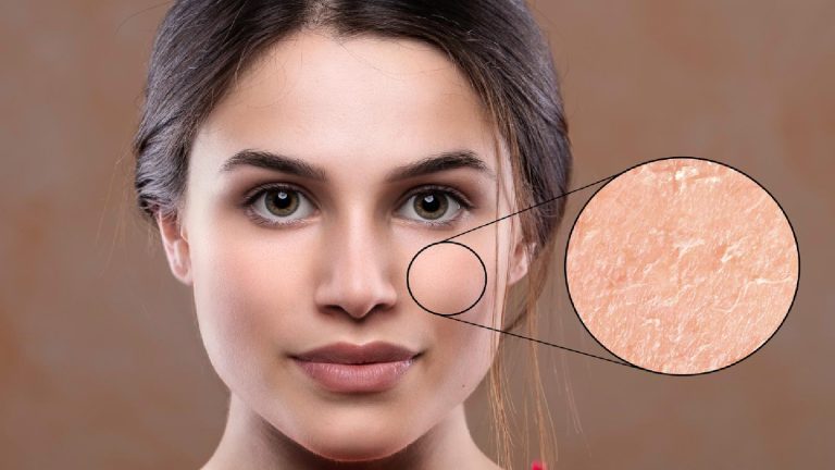5 best skin peeling products