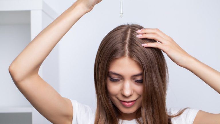 5 best hair oils for dandruff removal
