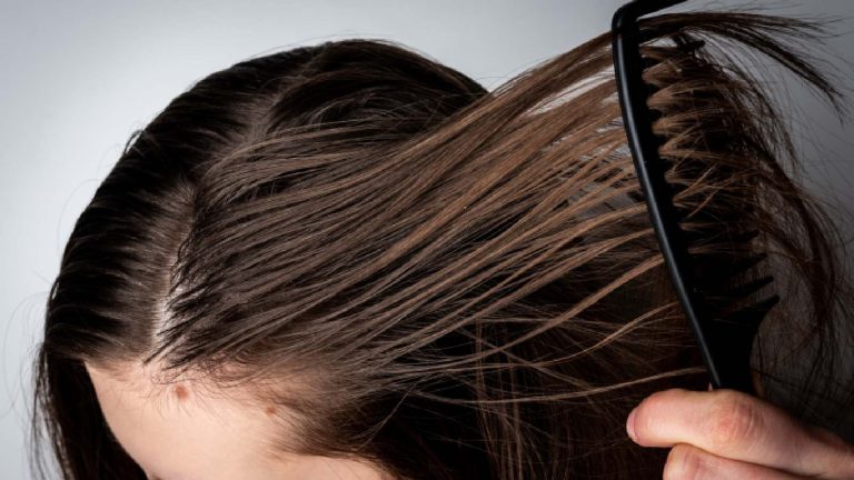 5 best shampoos for oily hair and scalp