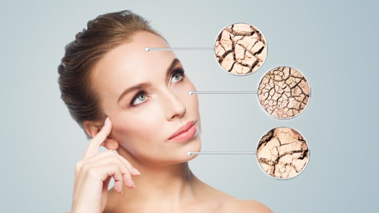 Protein deficiency can lead to skin problems