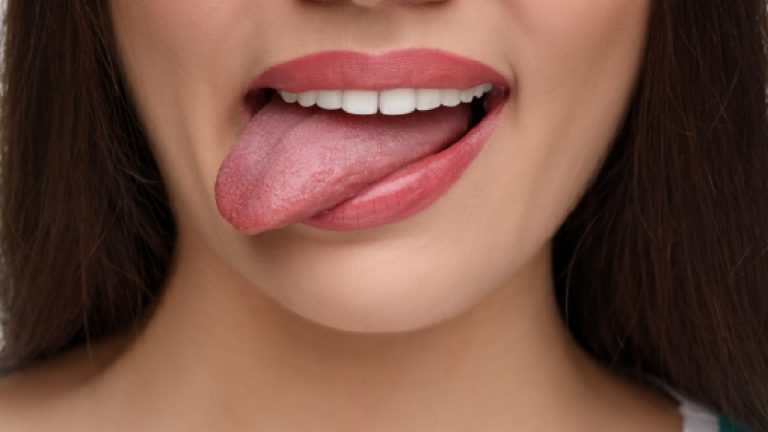 Yellow tongue: Why it happens and how to turn it pink again