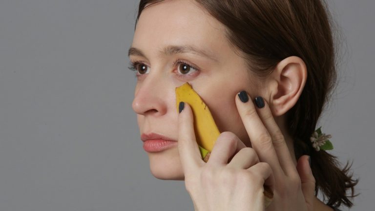 Can banana peel help alleviate symptoms of psoriasis?