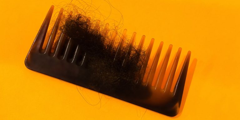 8 Causes of Hair Loss in Women That Have Nothing to Do With Age