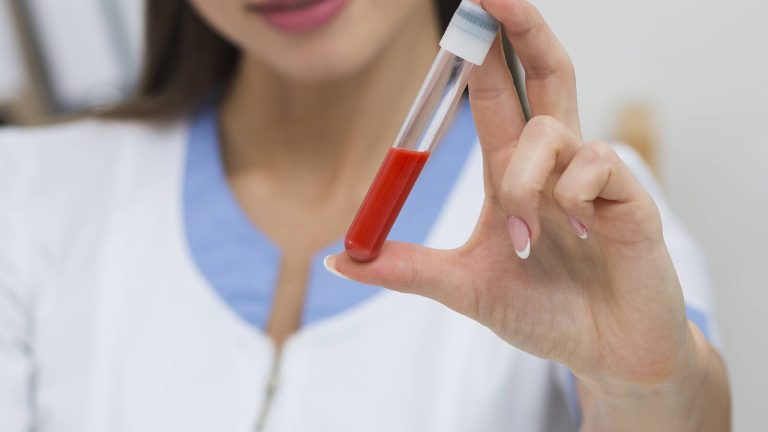 MCH levels in blood test: What does it mean?