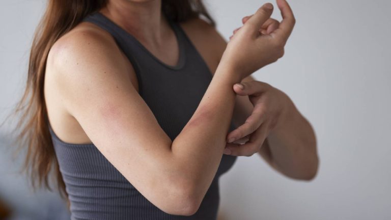 Skin rashes: Types, Causes, Diagnosis, Treatment