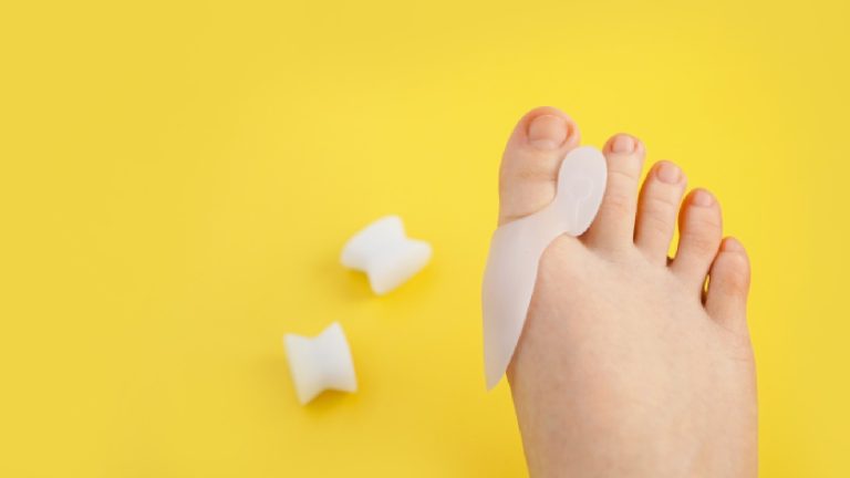 Best bunion correctors: 6 picks to realign toe joints