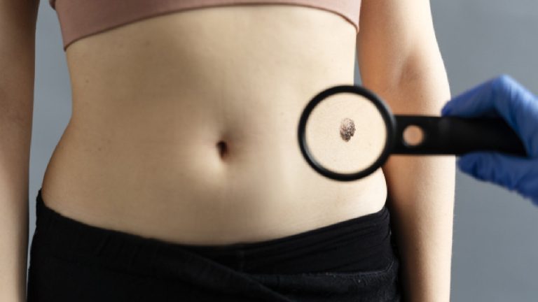 Belly button discharge: Causes and treatment