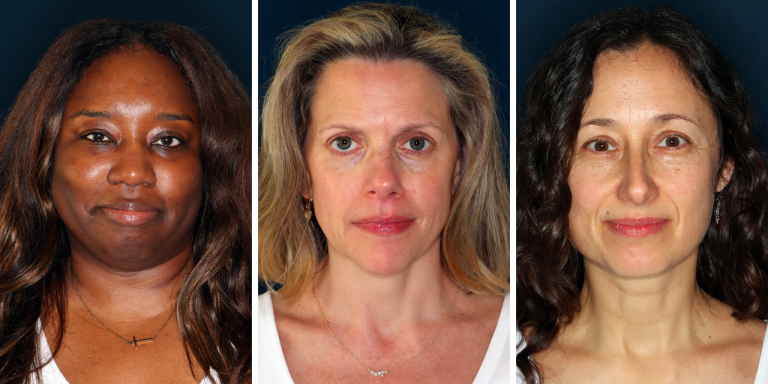 This Is What a 52-Year-Old Face Without Filters or Makeup Looks Like