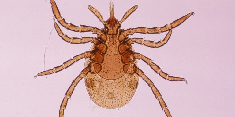 5 Signs of Lyme Disease You Really Shouldn’t Ignore