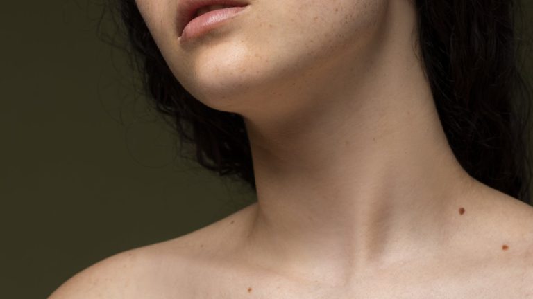 Skin tag vs mole: Similarities and differences