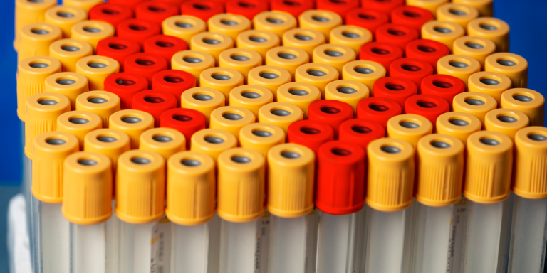 A Promising New Blood Test for Colorectal Cancer Is in the Works—Here’s What You Should Know