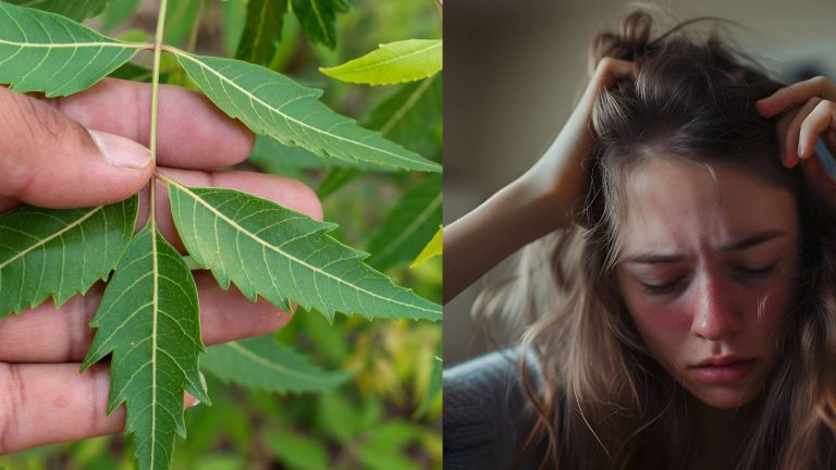 Neem for itchy scalp: Benefits and uses