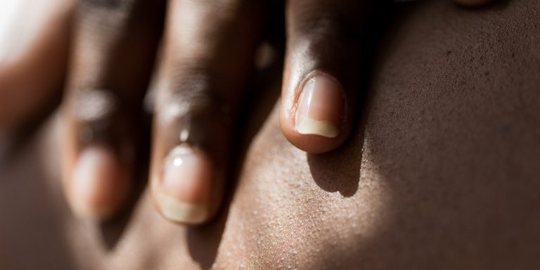 5 Symptoms of Skin Cancer in Your Nails That Are Easy to Miss