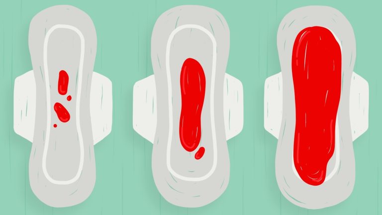 Spotting vs periods: Know the difference