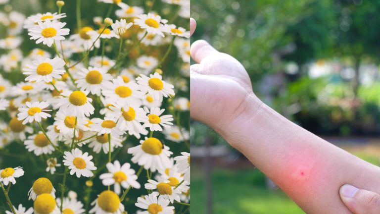 How to use chamomile for mosquito bites?