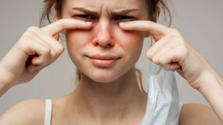 Are all eye infections contagious?